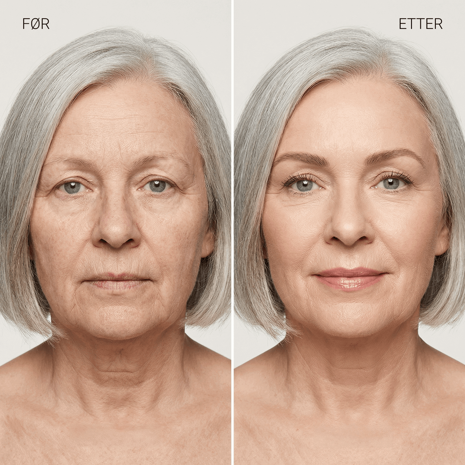 Changing Foundation